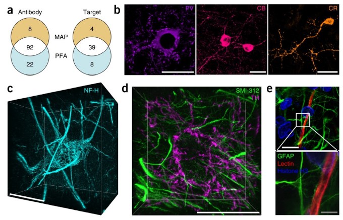 MAP-processed tissue after being tagged with fluorescent, protein-specific stains.