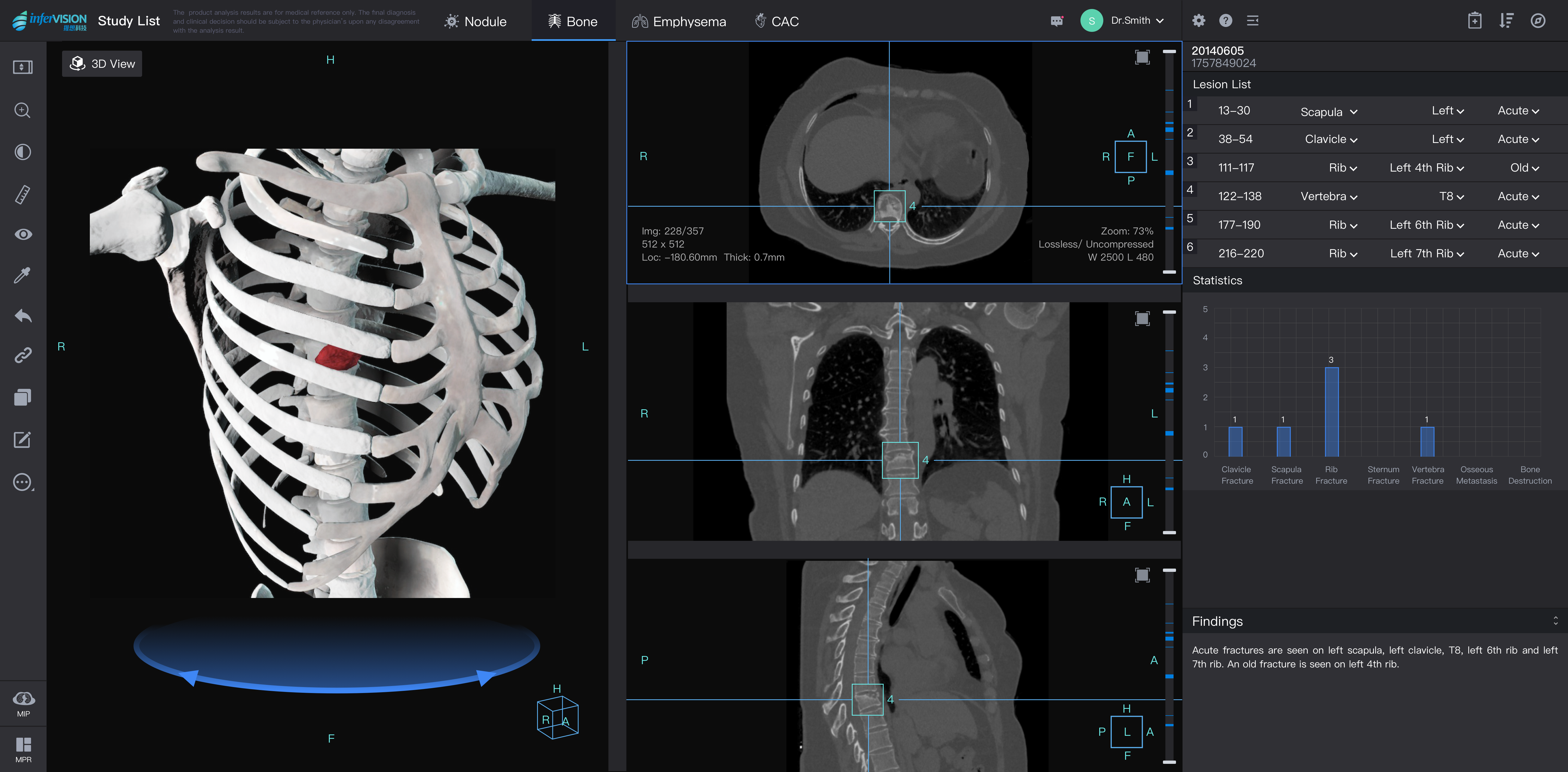 infervision medical imaging